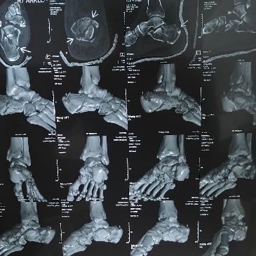 Foot and ankle care support image 1