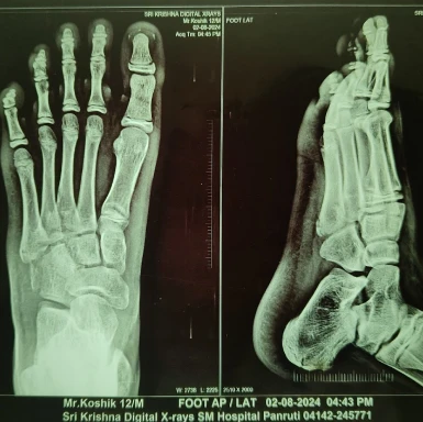 Sports injury recovery care